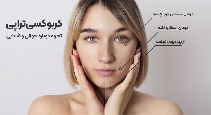 کاربردهای کربوکسی‌تراپی (Carboxytherapy)