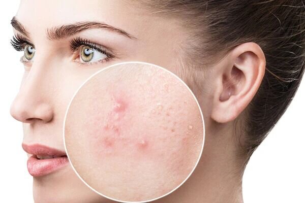 استراتژی‌های درمانی در کلینیک بهروز: از اطفاء حریق تا بازسازی